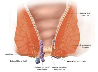 Hemorrhoid anatomy